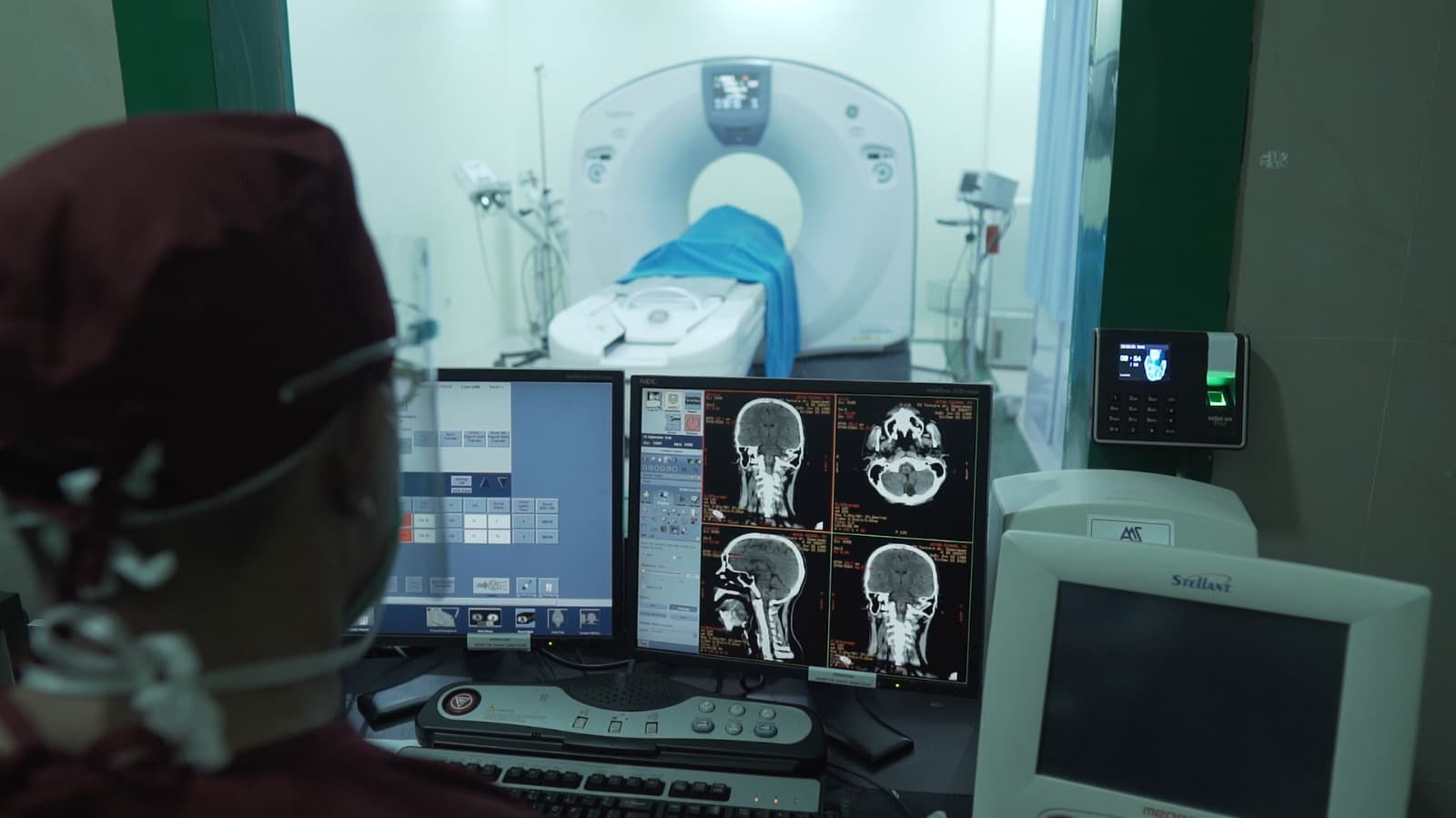 CT Scan